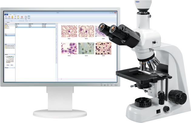 Vision Report Digital System for Microscopy Analysis and Report Generation