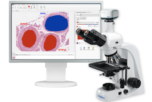 Vision Bio   Digital solution for analysis, report generation and management of digital albums in microscopy