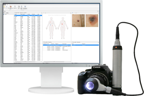 Vision Derma Digital solutions for examination, report generation and management of dermatoscopy studies