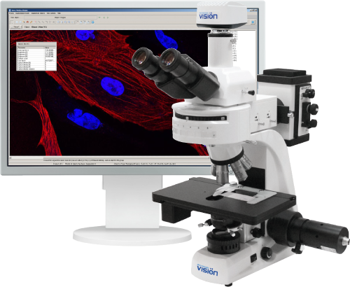 Vision Epi Digital solutions for morphological analysis in fluorescence microscopy