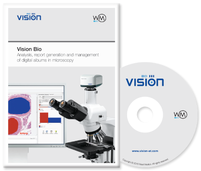 Vision Bio Software for analysis, report generation and managing digital albums in microscopy