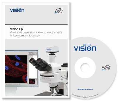 Vision Epi Software for virtual slide preparation and morphology analysis in fluorescence microscopy