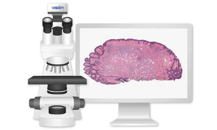 Vision Slide® Basic Convert your microscope into a digital scanner
