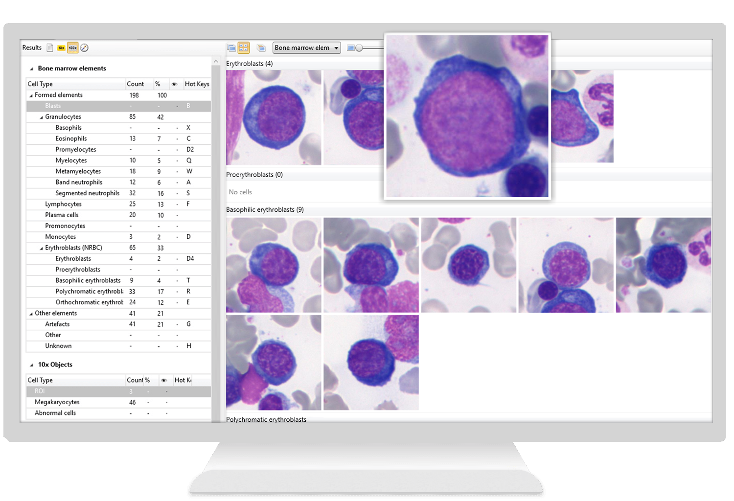 Vision Hema® Bone Marrow Analysis of bone marrow cells