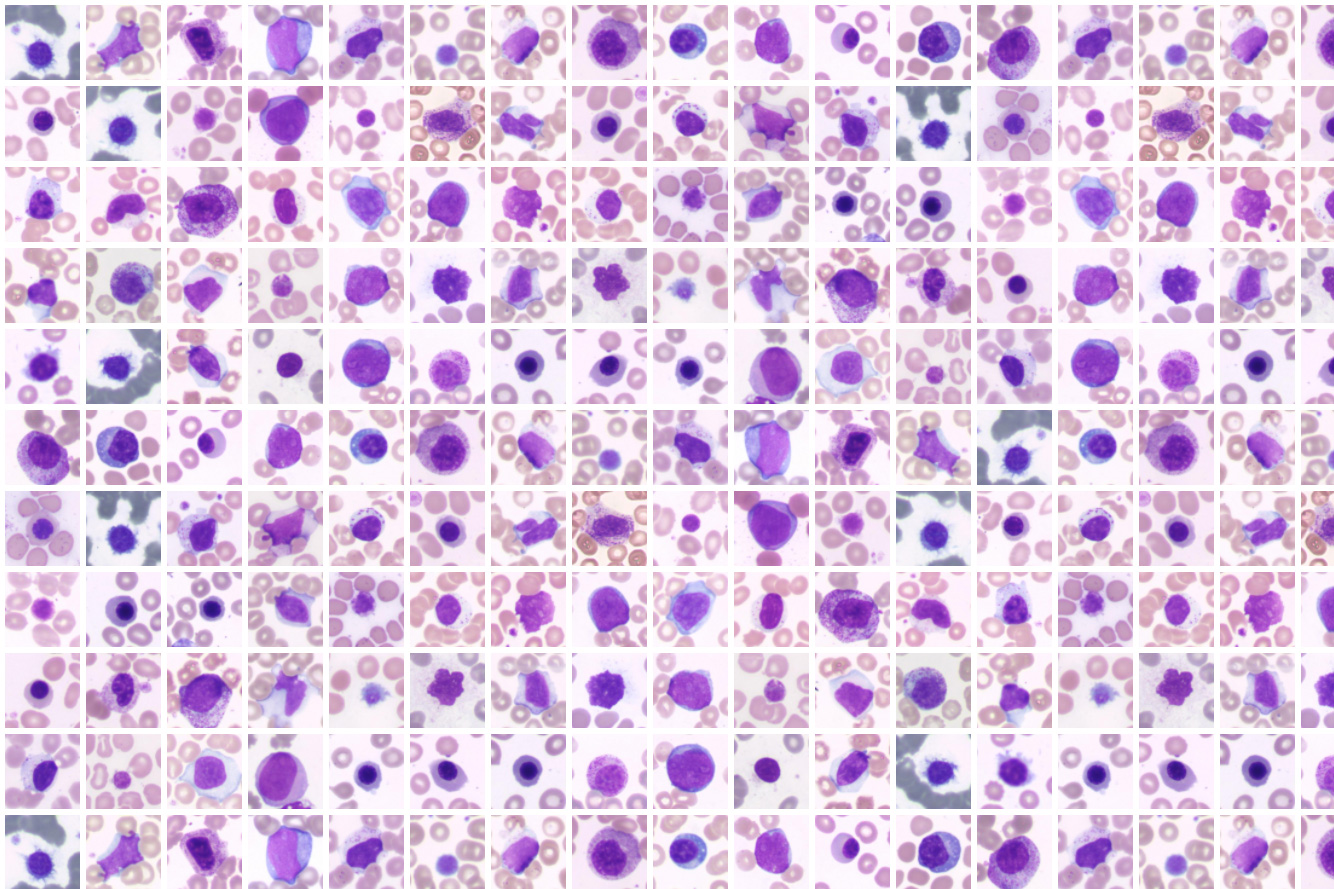 Vision Hema — Analysis of pathological and complex cells
