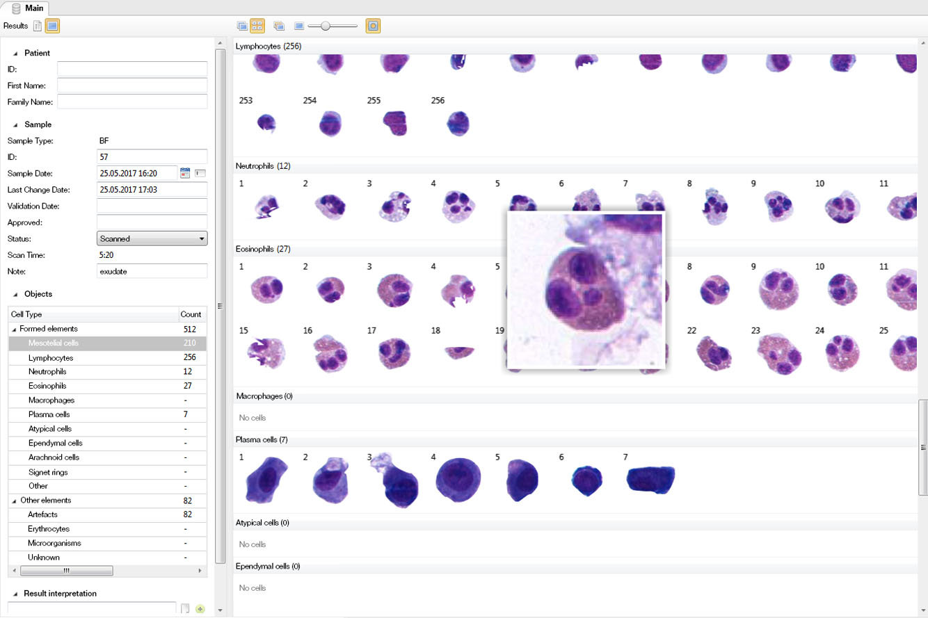 Vision Hema — Cell morphology in human body fluids