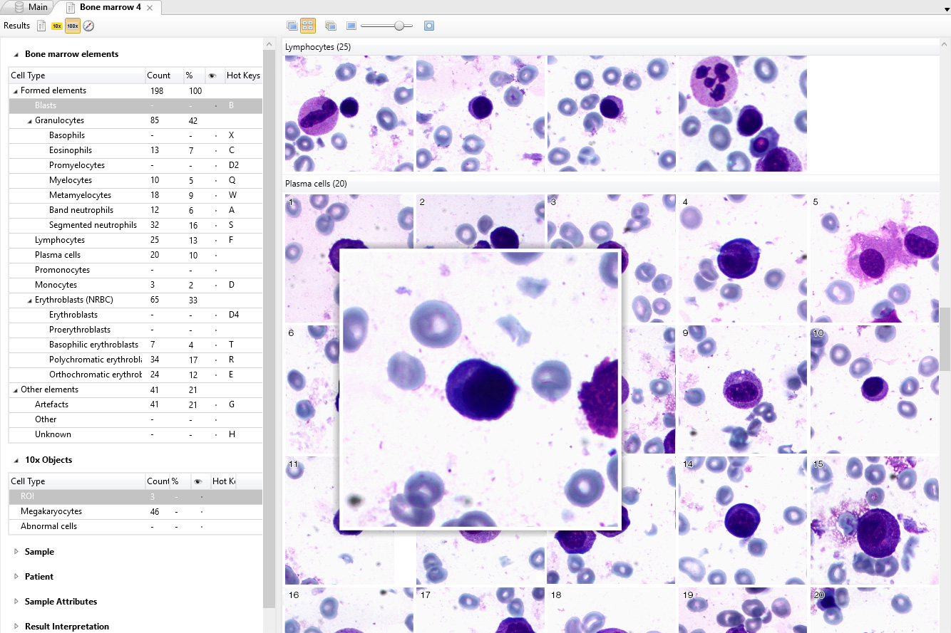 Vision Hema — Bone marrow analysis
