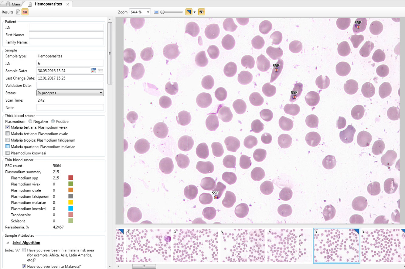 Vision Hema — Automated systems for analysis of malaria