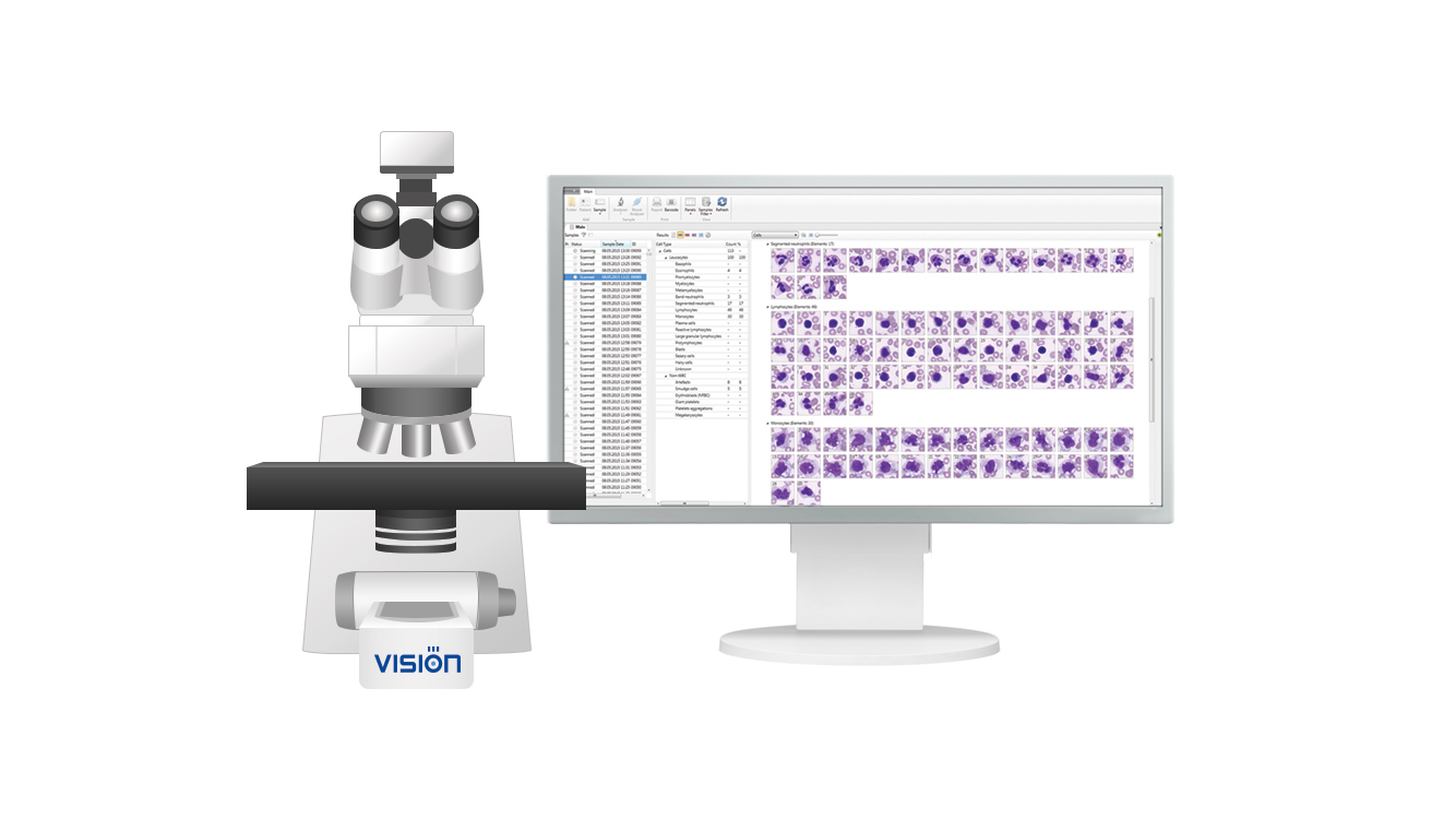 Vision Hema — Select the optimal platform