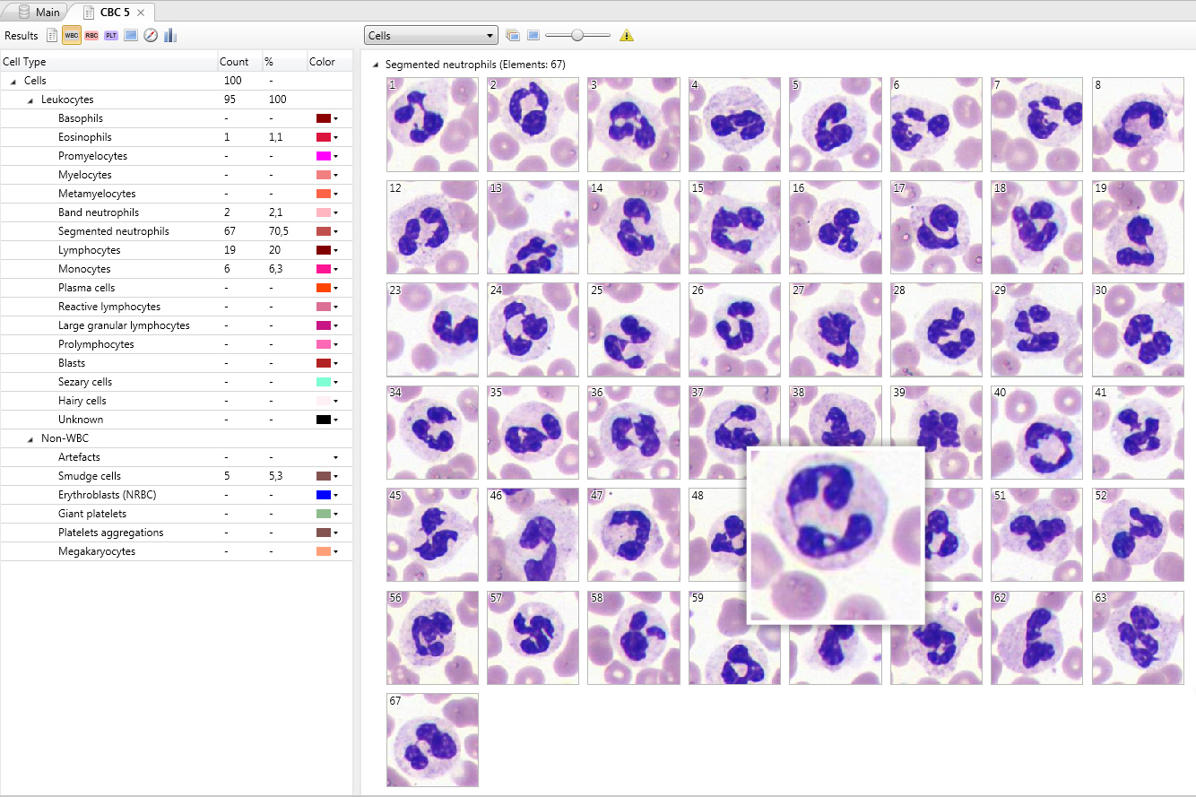 Vision Hema — Identification and pre-classification of leukocytes in blood smear