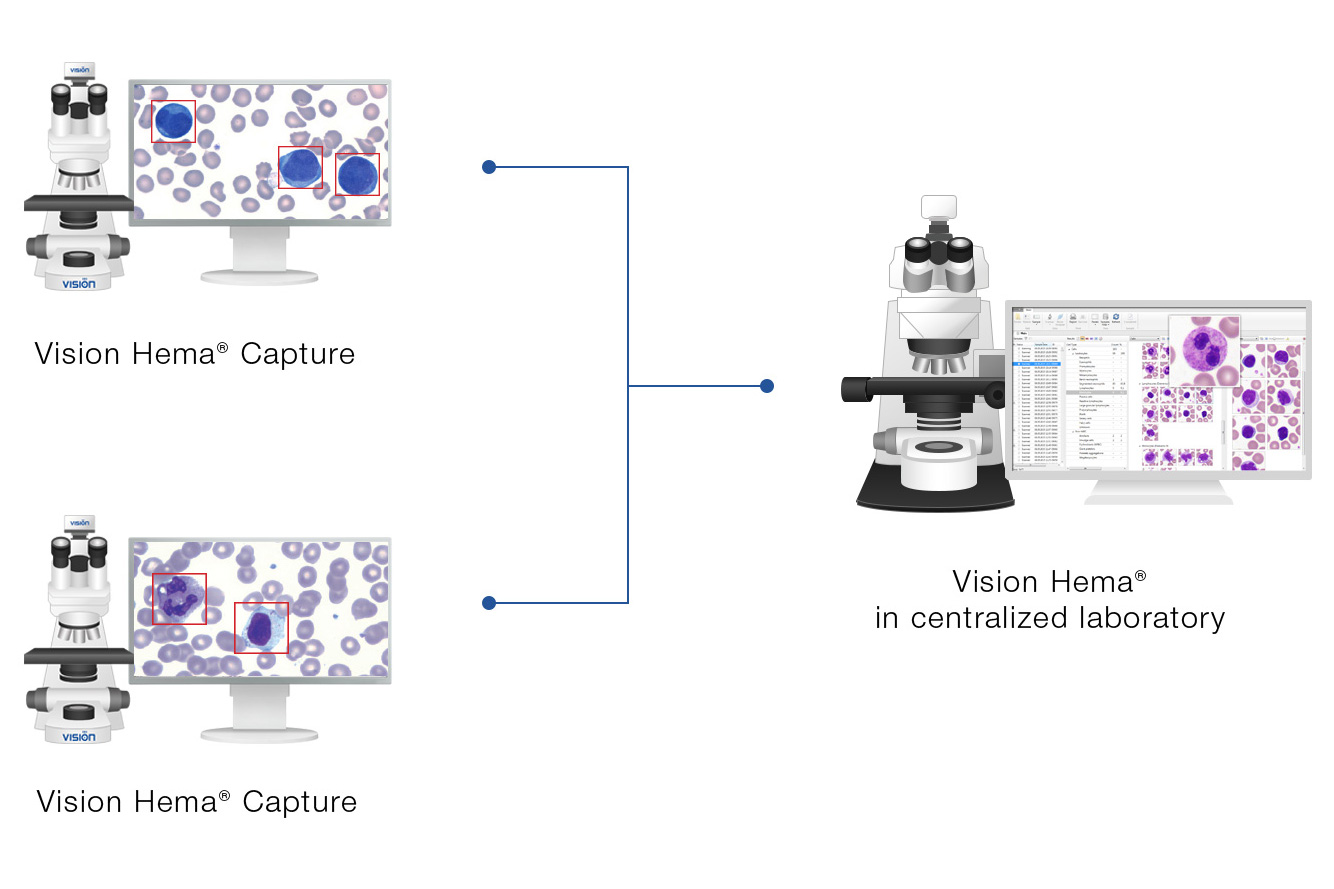 Vision Hema Capture — Capture the images of blood cells