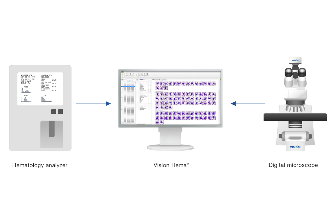 Vision Hema Integro — Integrated hematology solution