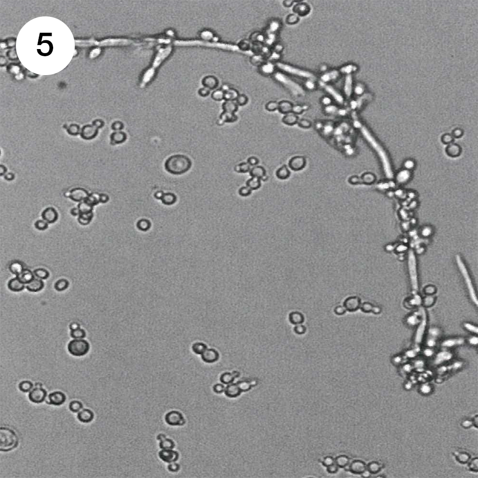 Дрожжеподобные грибы candida. Микроскопия кандиды псевдомицелий. Грибок кандида псевдомицелий. Дрожжевой грибок кандида. Псевдомицелий гриба рода Candida.